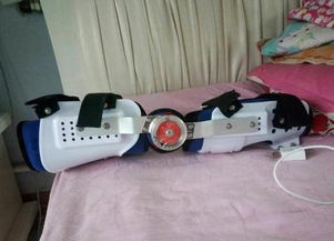 假肢矯形器價格解析與蕪湖德康假肢矯形器服務介紹